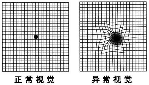 Led照明中藍(lán)光危害，尤其是對(duì)兒童。